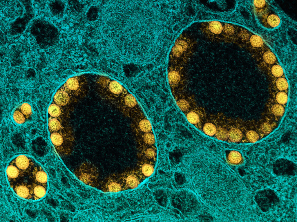 A transmission electron micrograph shows several round and oval membrane-bound compartments embedded within a textured cellular matrix. Each compartment contains numerous small spherical particles arranged in a ring along its inner edge, with darker, empty-looking space at the center of each compartment. Smaller isolated clusters of the same spherical particles appear near the edges of the image.