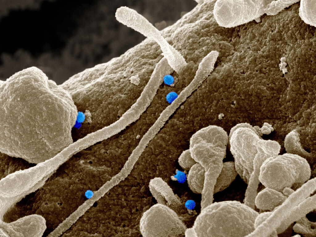 A scanning electron microscope image showing multiple small round virus particles budding from the surface of cultured cells. Elongated cellular projections and clustered protrusions extend across the textured cell surface. The virus particles appear as distinct rounded structures attached to these filamentous extensions, illustrating the viral budding process at high magnification.