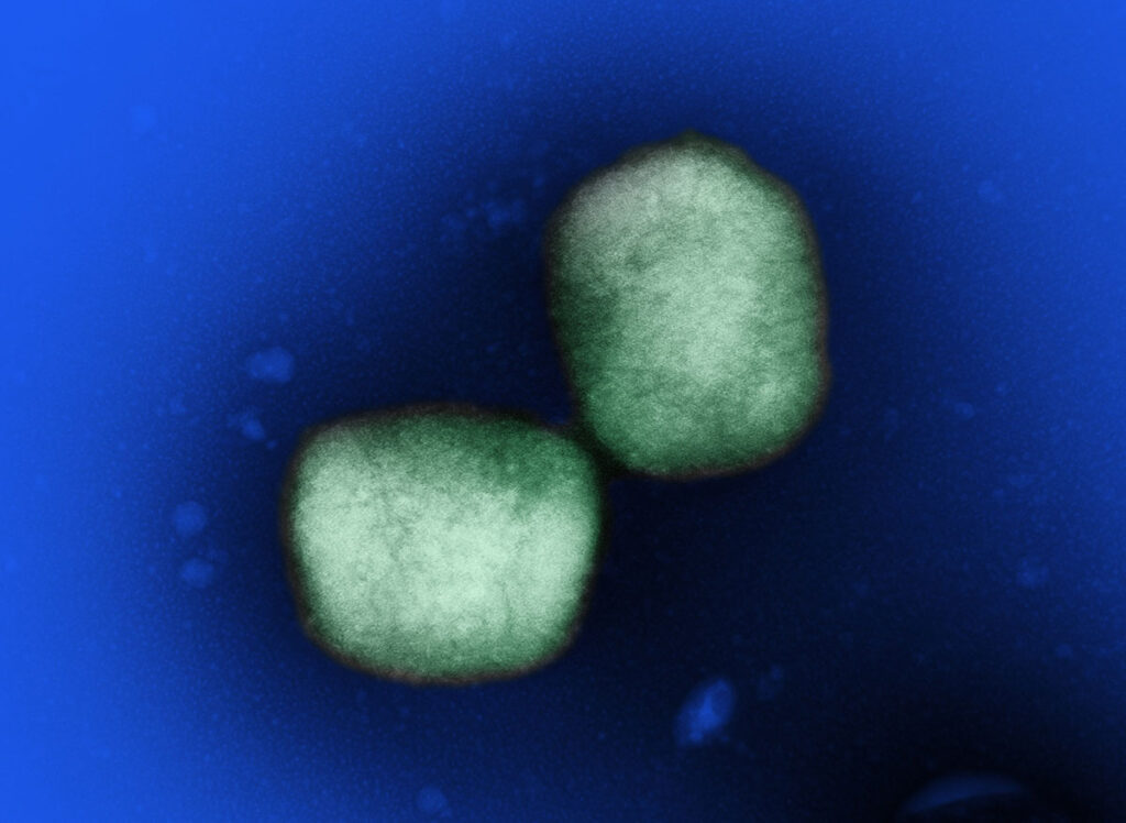 Mpox Vaccine Protection Fades Faster Than Expected, Two-Year Study Finds A transmission electron microscope image showing two mpox virus particles at high magnification against a dark background. The virions display the characteristic oval morphology of orthopoxviruses with visible surface texture and internal structure. Additional smaller viral particles and cellular debris are visible in the background. The image captures the distinctive appearance of mpox at the ultrastructural level.