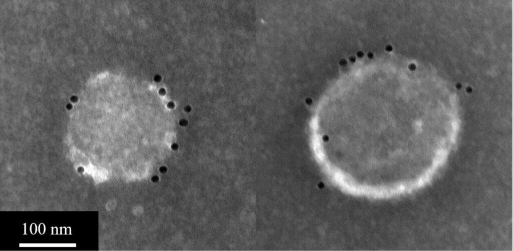 Two grayscale electron microscopy images side by side, each showing a round particle with a textured, granular surface studded with small dark dots along its outer edge, representing individual proteins. The left particle is smaller and more irregularly shaped with dots concentrated along one side; the right particle is larger, more uniformly circular, and shows dots spaced around its perimeter. A scale bar in the bottom left corner reads "100 nm."