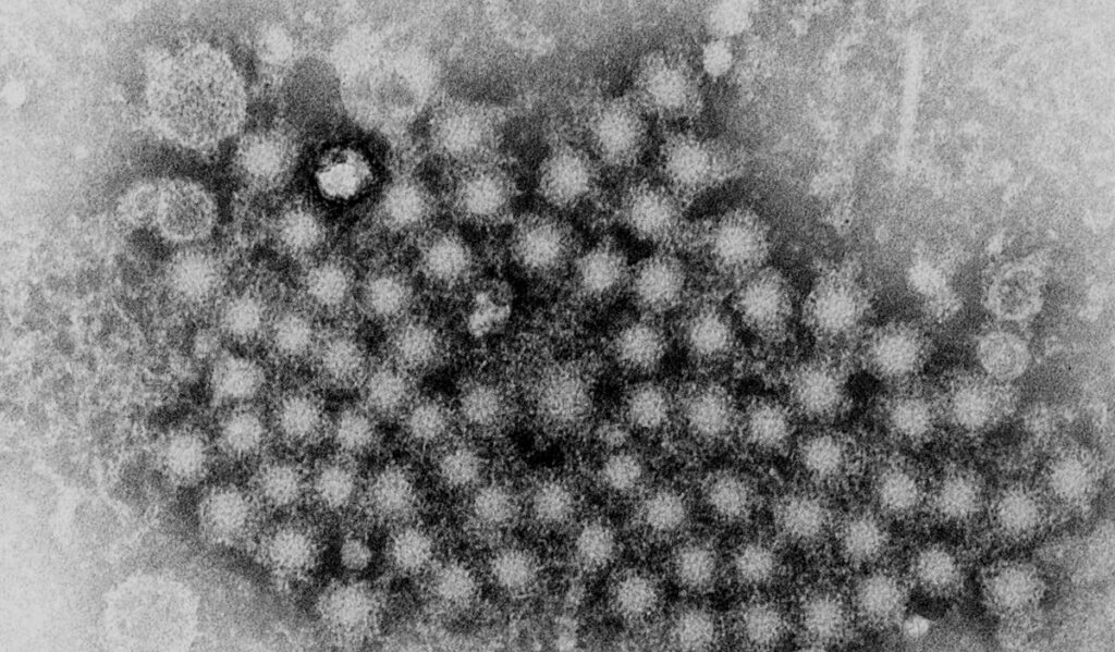 A grainy electron micrograph shows dozens of small round particles with a stippled, textured surface, densely packed together in an irregular cluster against a mottled background. One larger ring-shaped structure with a bright center appears near the upper left of the cluster.