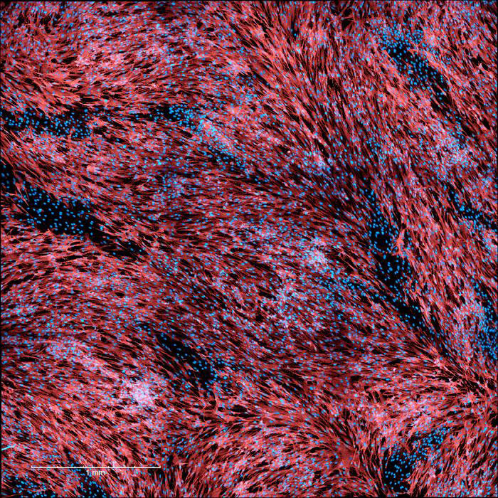 New Research Reveals How Seminal Fluid Actively Amplifies Mpox Infectivity A dense field of elongated, spindle-shaped cells arranged in sweeping, overlapping streams and whorls fills the frame, densely packed and oriented in flowing patterns. Small round dots representing cell nuclei are scattered throughout the tissue, clustering more heavily in some regions than others. A scale bar in the bottom left corner indicates 1 millimeter.