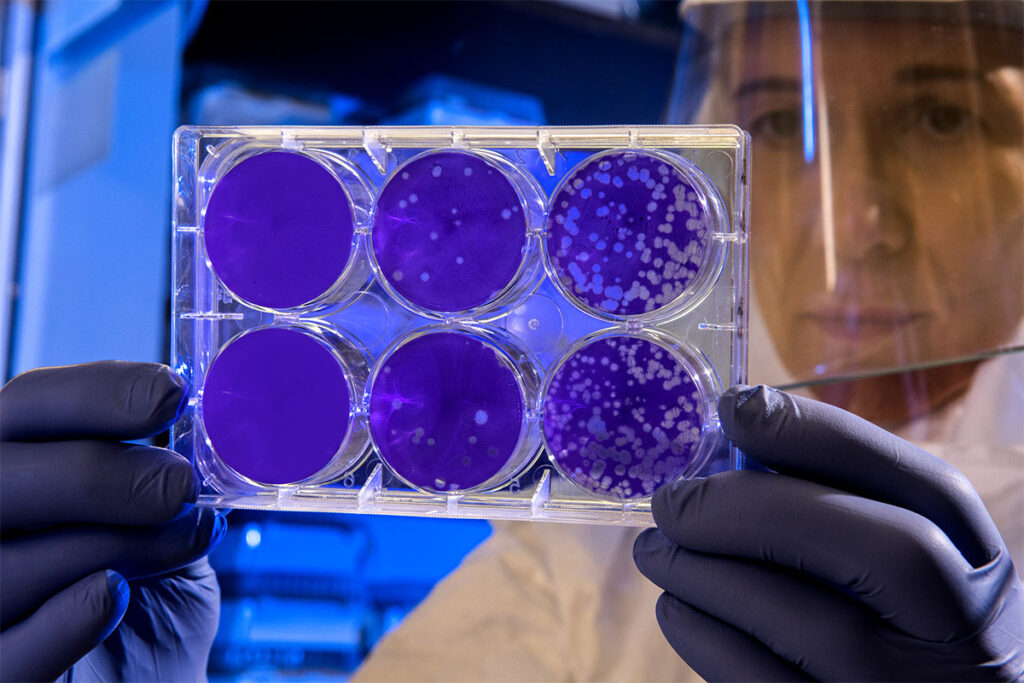Global Biodefense Today — September 2, 2026 A researcher wearing a face shield and protective gear holds up a six-well plate close to the camera, with each circular well showing a deep purple stain and varying numbers of small pale clear spots scattered across the surface. The researcher's face is visible behind the shield, gazing down at the plate.